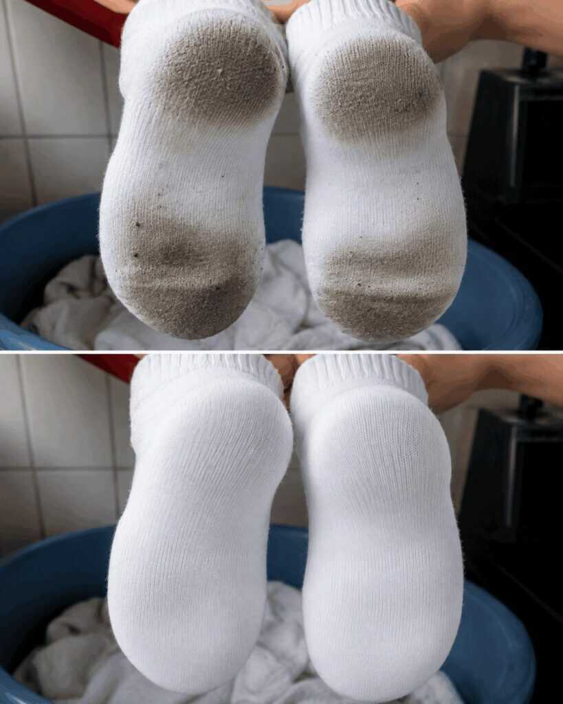 Weiße Socken wieder strahlend sauber: Hartnäckige Sohlenflecken mit einfachen Hausmitteln entfernen