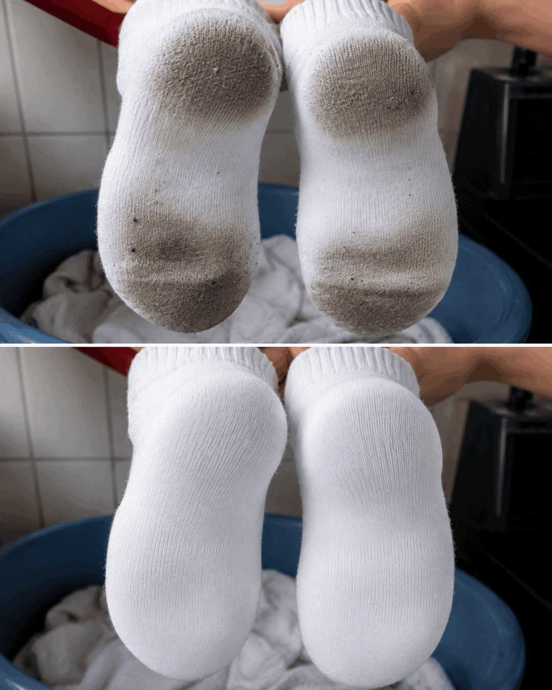 Weiße Socken wieder strahlend sauber: Hartnäckige Sohlenflecken mit einfachen Hausmitteln entfernen